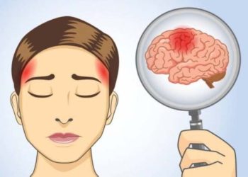 लगातार टाउको दुखिरहन्छ ? हुनसक्छ ब्रेन ट्युमरको सुरुवाती लक्षण