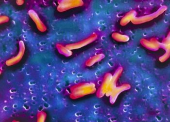 कैलालीसहित पाँच जिल्लामा फैलियो हैजा