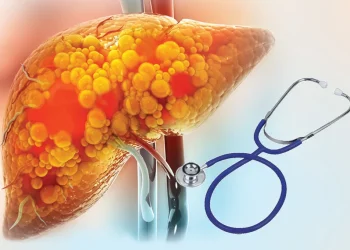 फ्याटी लिभर रोगः लक्षण, कारण, निदान र उपचार